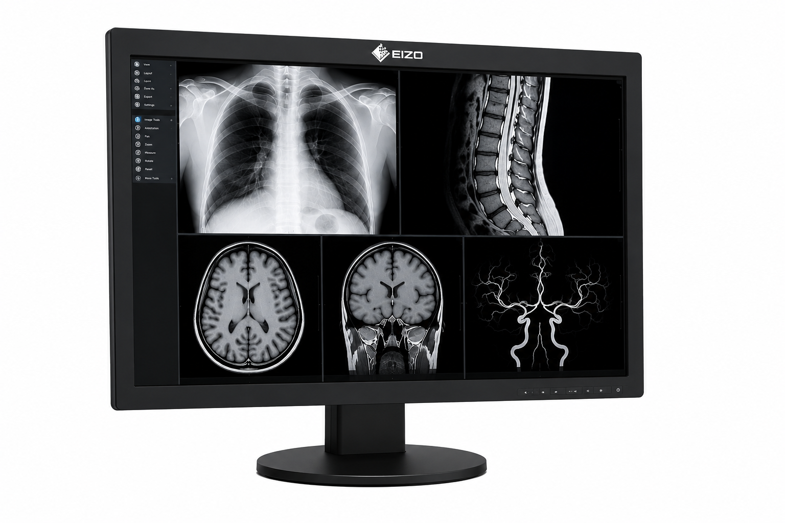 Diagnostic Equipment